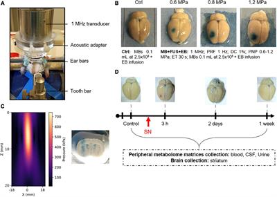 First Metabolomic Signature of Blood-Brain Barrier Opening Induced by Microbubble-Assisted Ultrasound